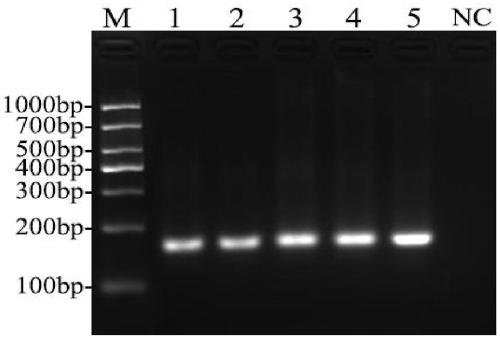 Primer set for performing fluorescence quantitative PCR detection on decapod iridescent virus 1 ( Decapod iridescent virus 1, DIV1 ) and reagent kit