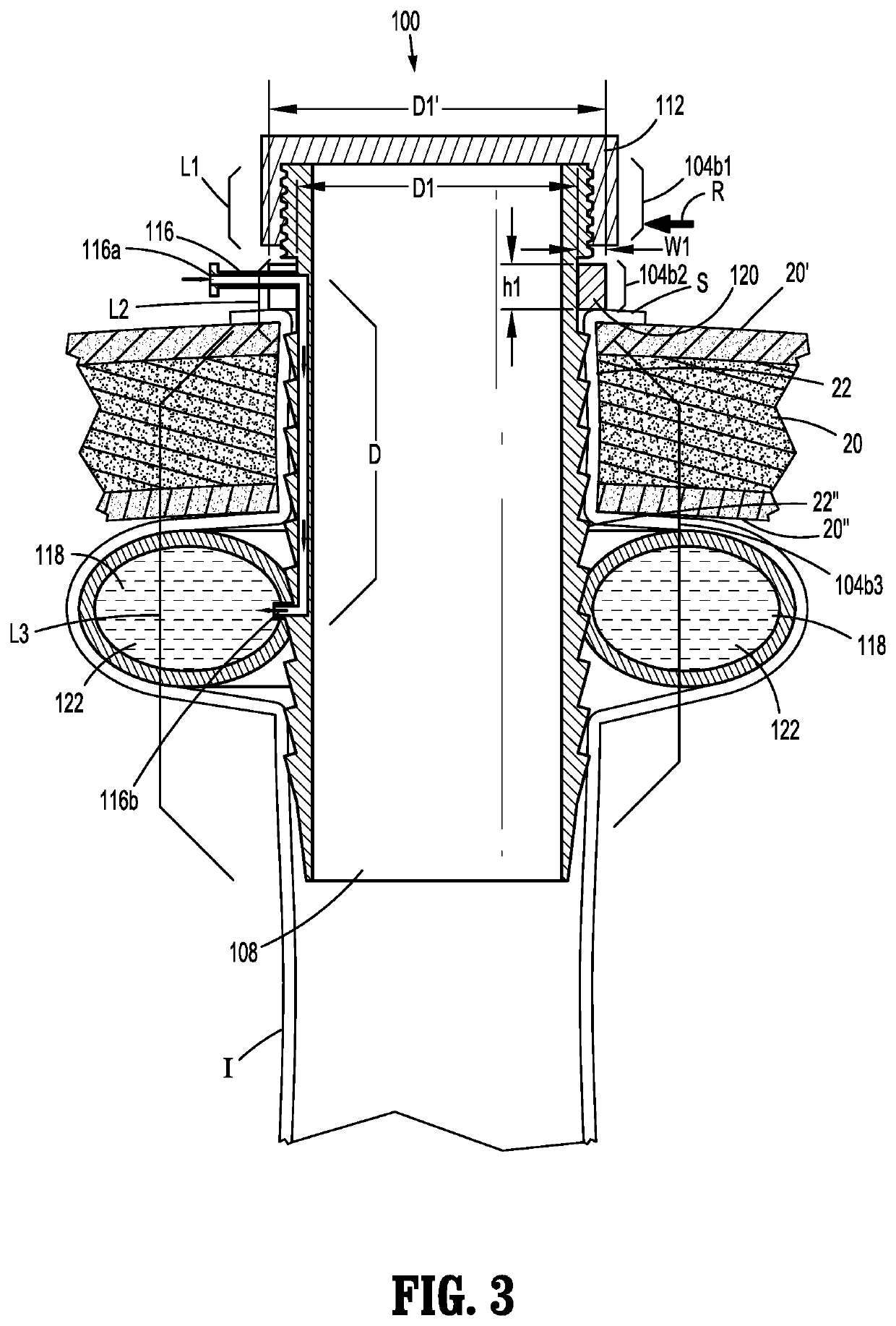 Connection devices for ostomy procedures