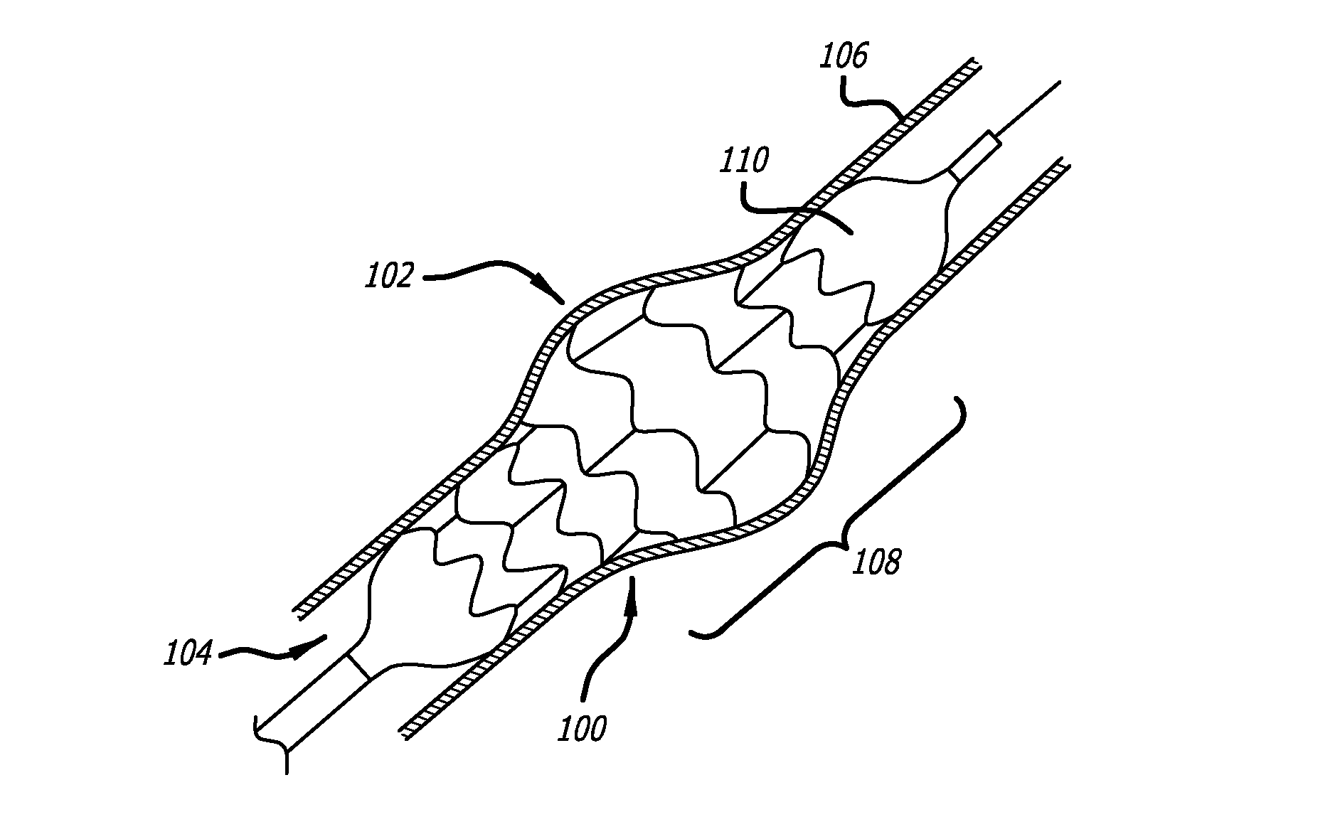 Methods of treating a condition of a vessel in a patient