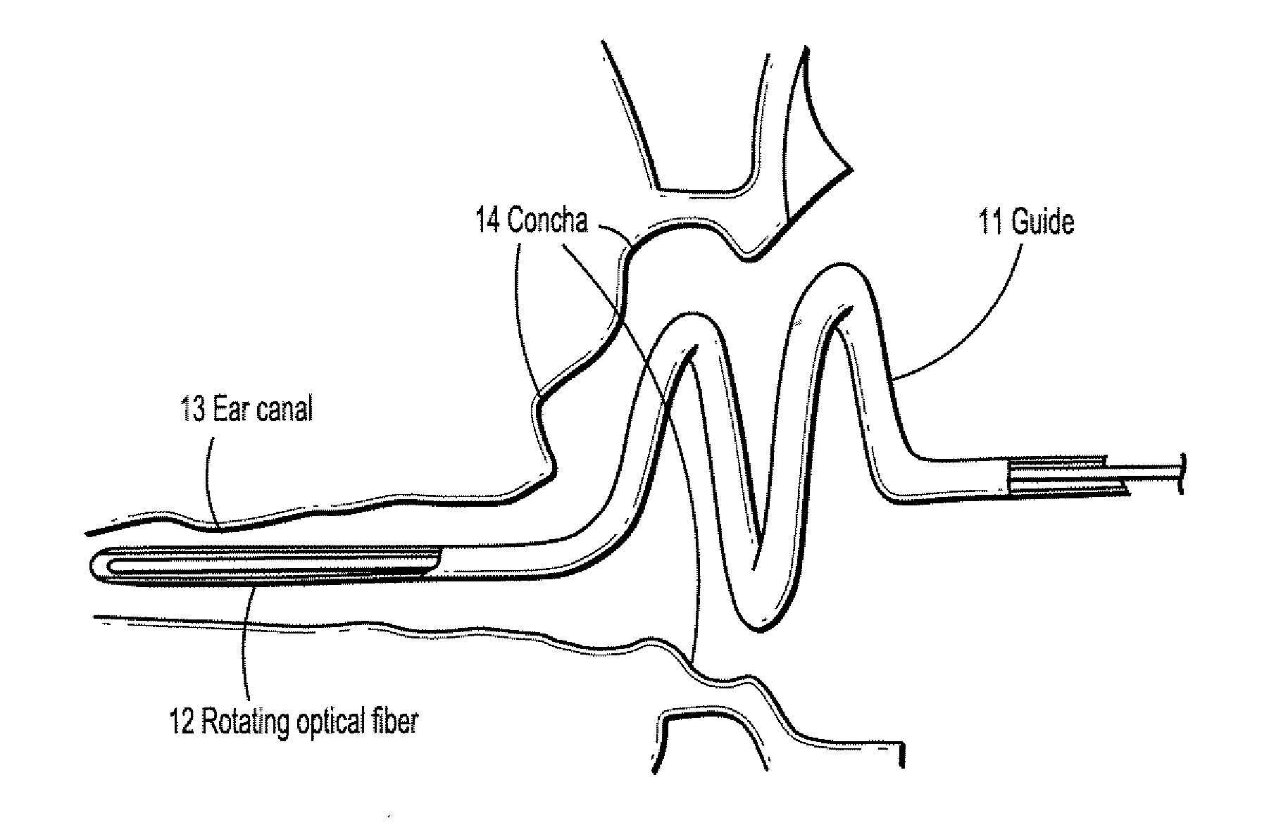 System and method for reconstruction of the human ear canal from optical coherence tomography scans