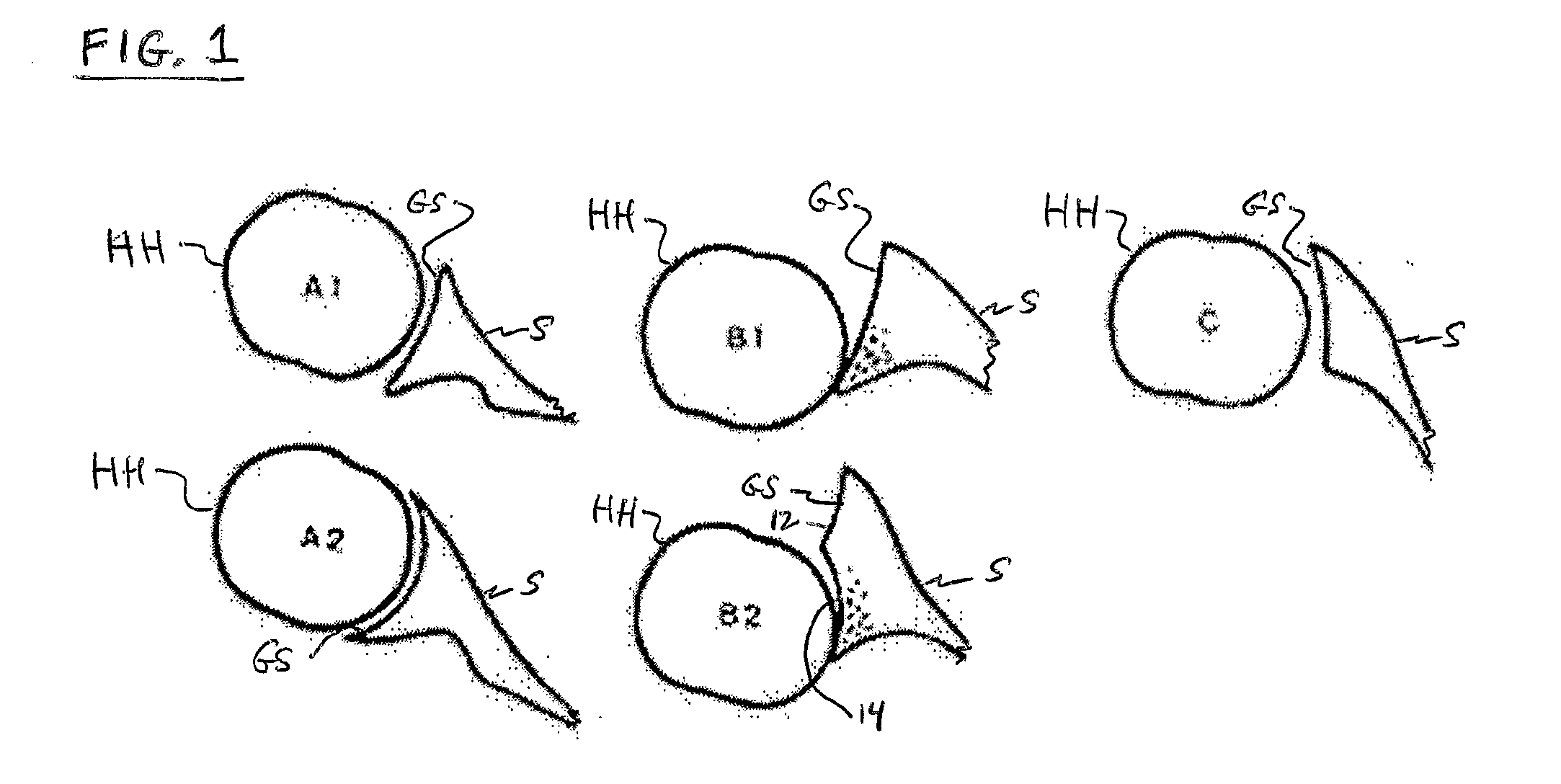 Shoulder patient specific instrument