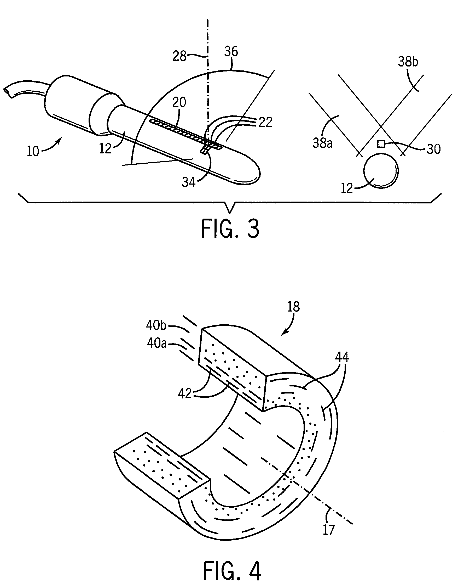 Method and apparatus for assessing risk of preterm delivery