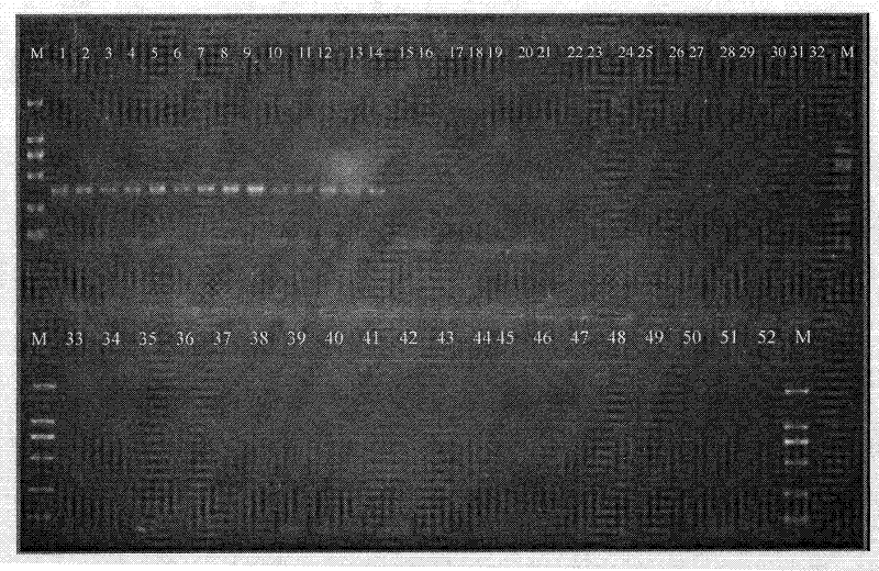 Specific gene sequence of tilletia controversa kuhn, specific SCAR marker and PCR detection method