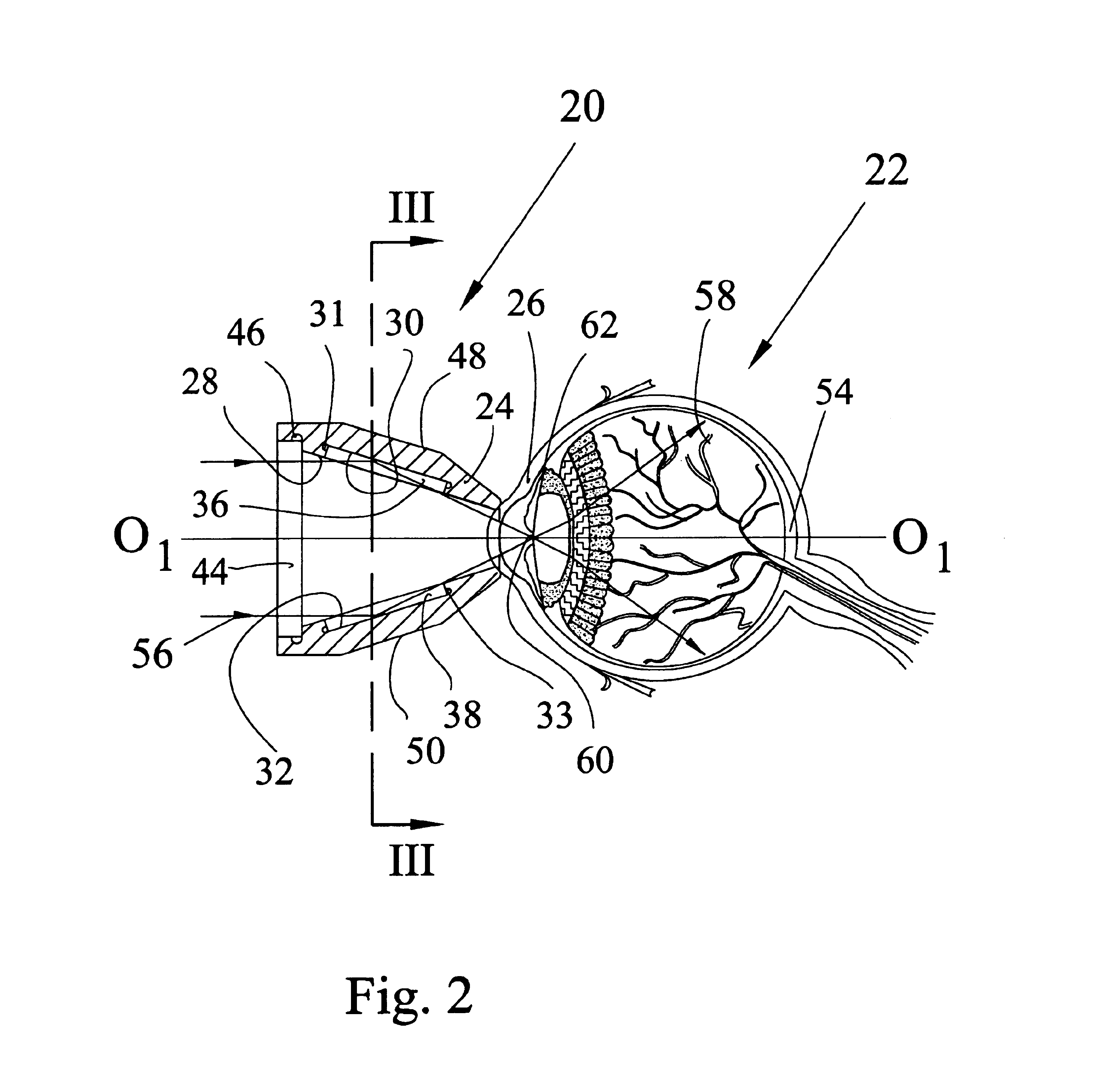 Optical device for intraocular observation