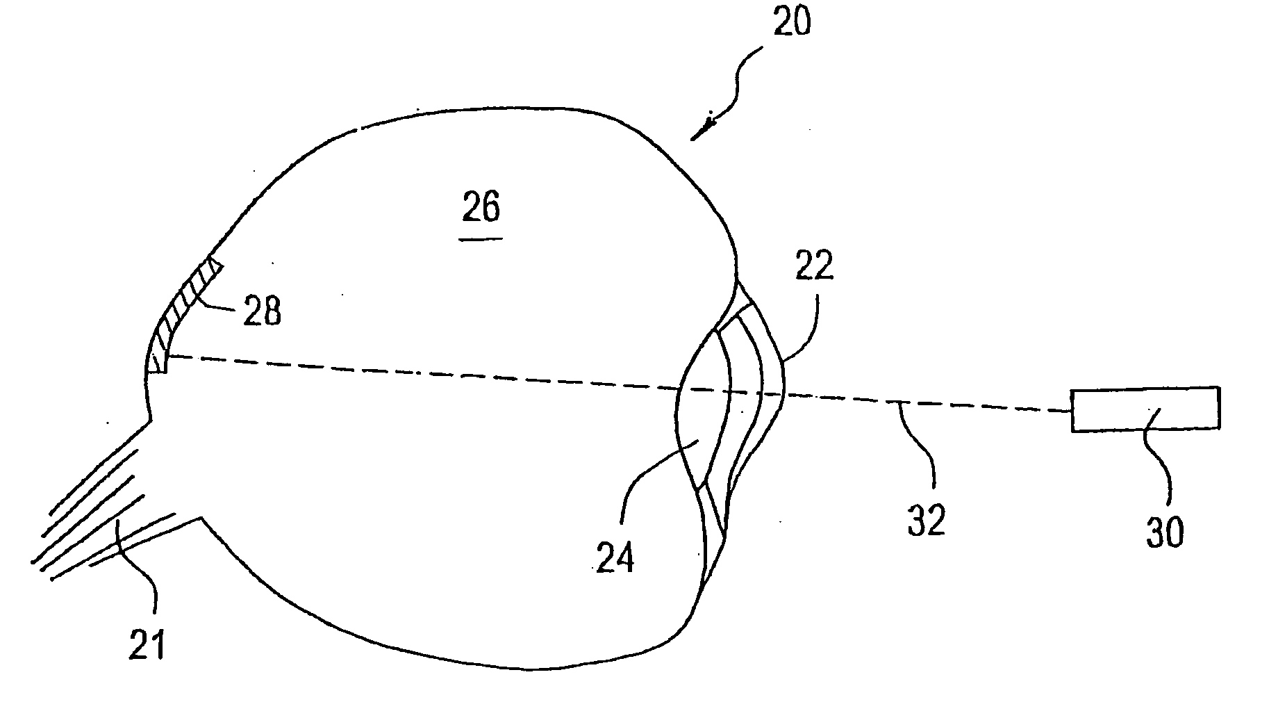 Implantable, tissue conforming drug delivery device