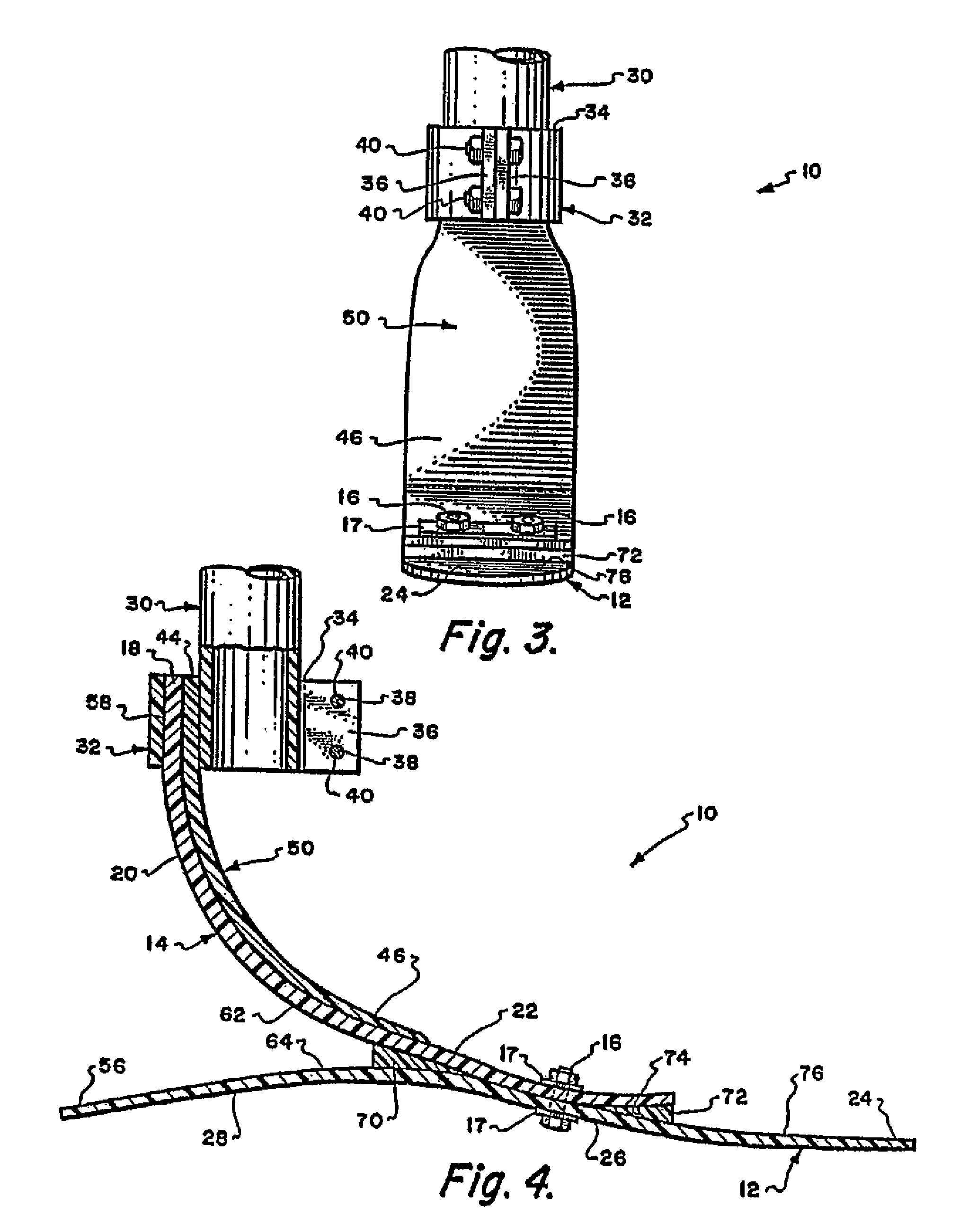 Prosthetic foot having curved ankle section