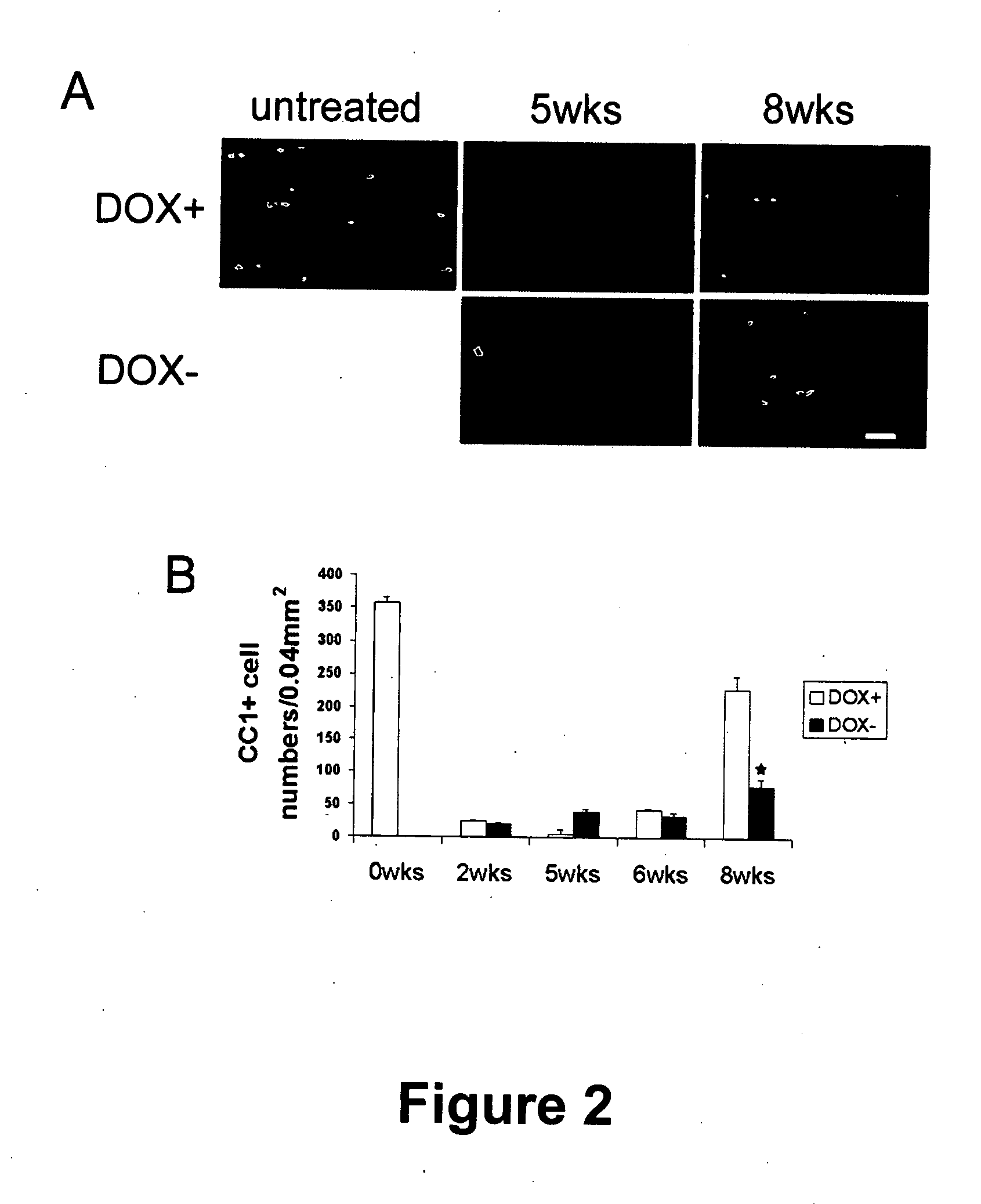 Animal models for demyelination disorders