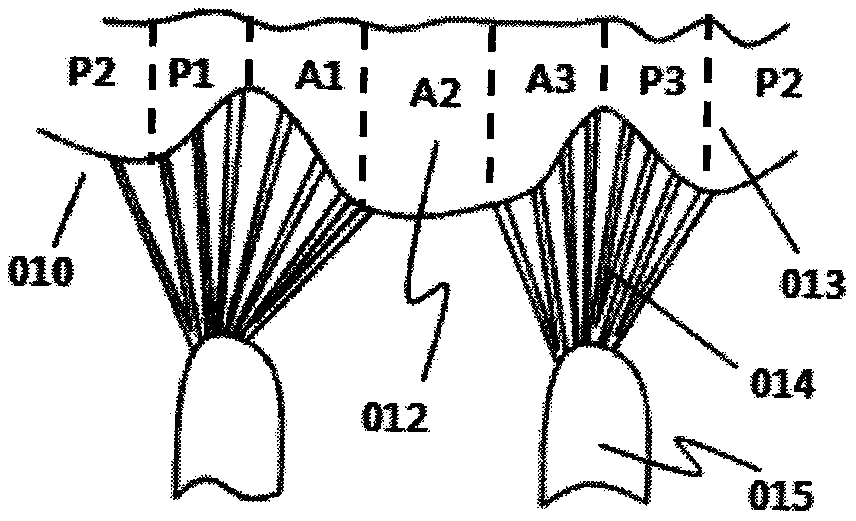 Substep clamping-type valve prosthesis and conveying system thereof