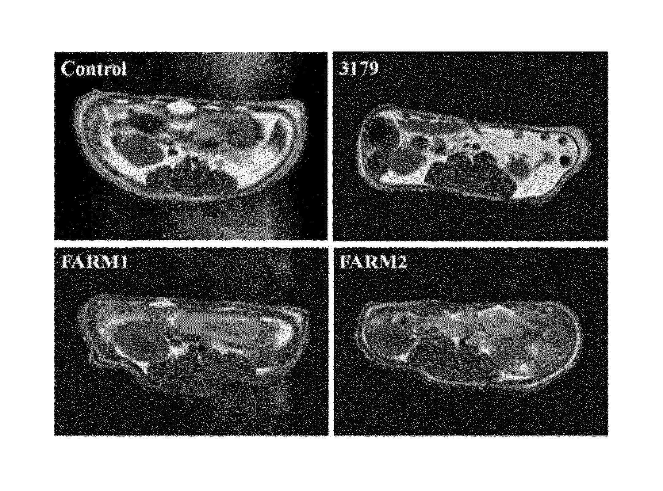 Compositions and methods for prevention and treatment of obesity and obesity related metabolic syndrome