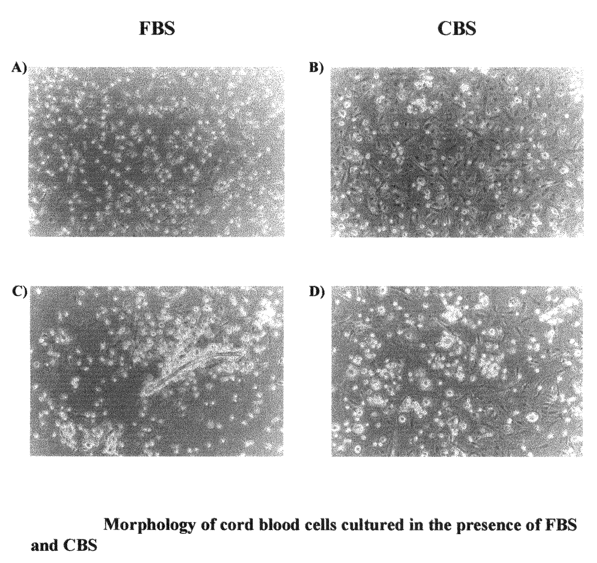 Growth of neural precursor cells using umbilical cord blood serum and a process for the preparation for therapeutic purposes