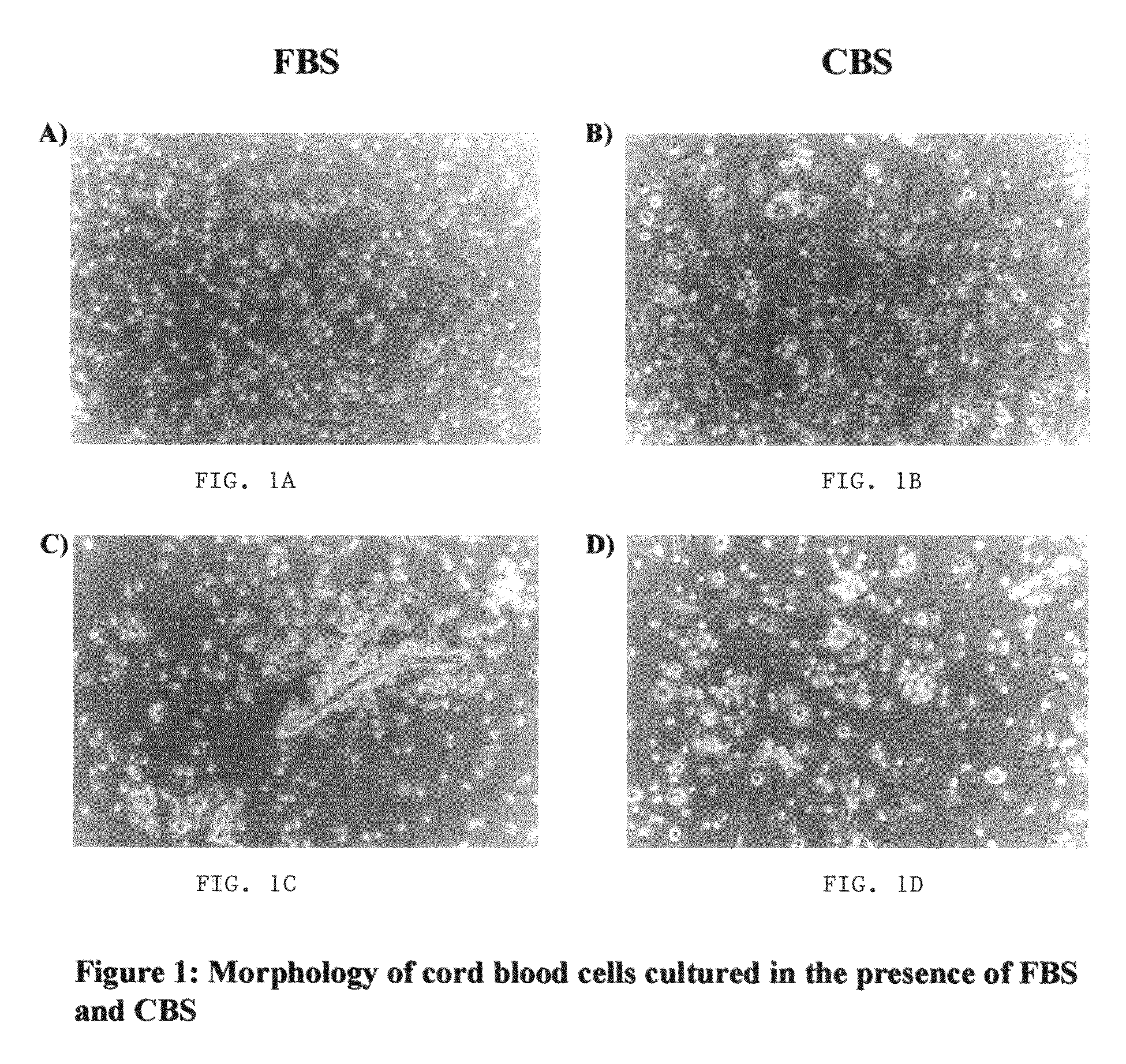 Growth of neural precursor cells using umbilical cord blood serum and a process for the preparation for therapeutic purposes