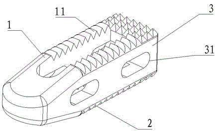 Interbody fusion cage