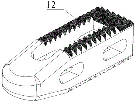 Interbody fusion cage