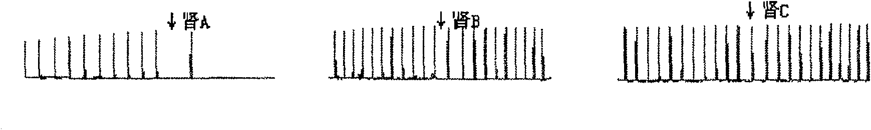 Clerodendranthus spicatus anti-urinary-stone extract and preparing method thereof