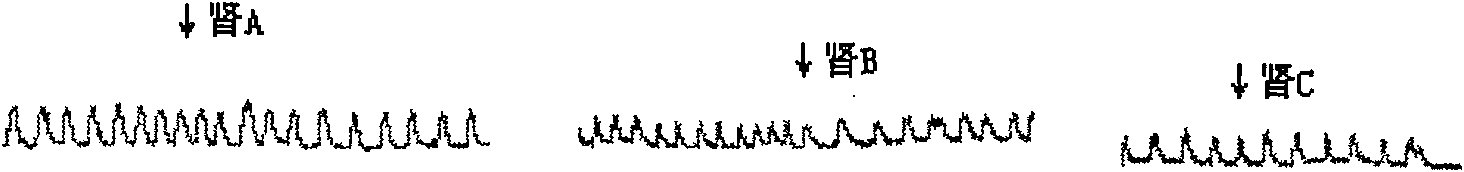 Clerodendranthus spicatus anti-urinary-stone extract and preparing method thereof