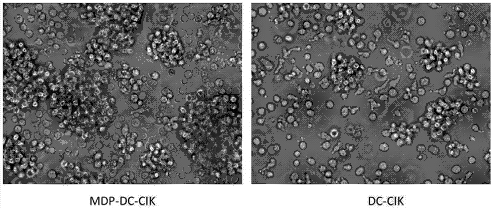 Method for inducing DC-CIK by utilizing muramyl dipeptide