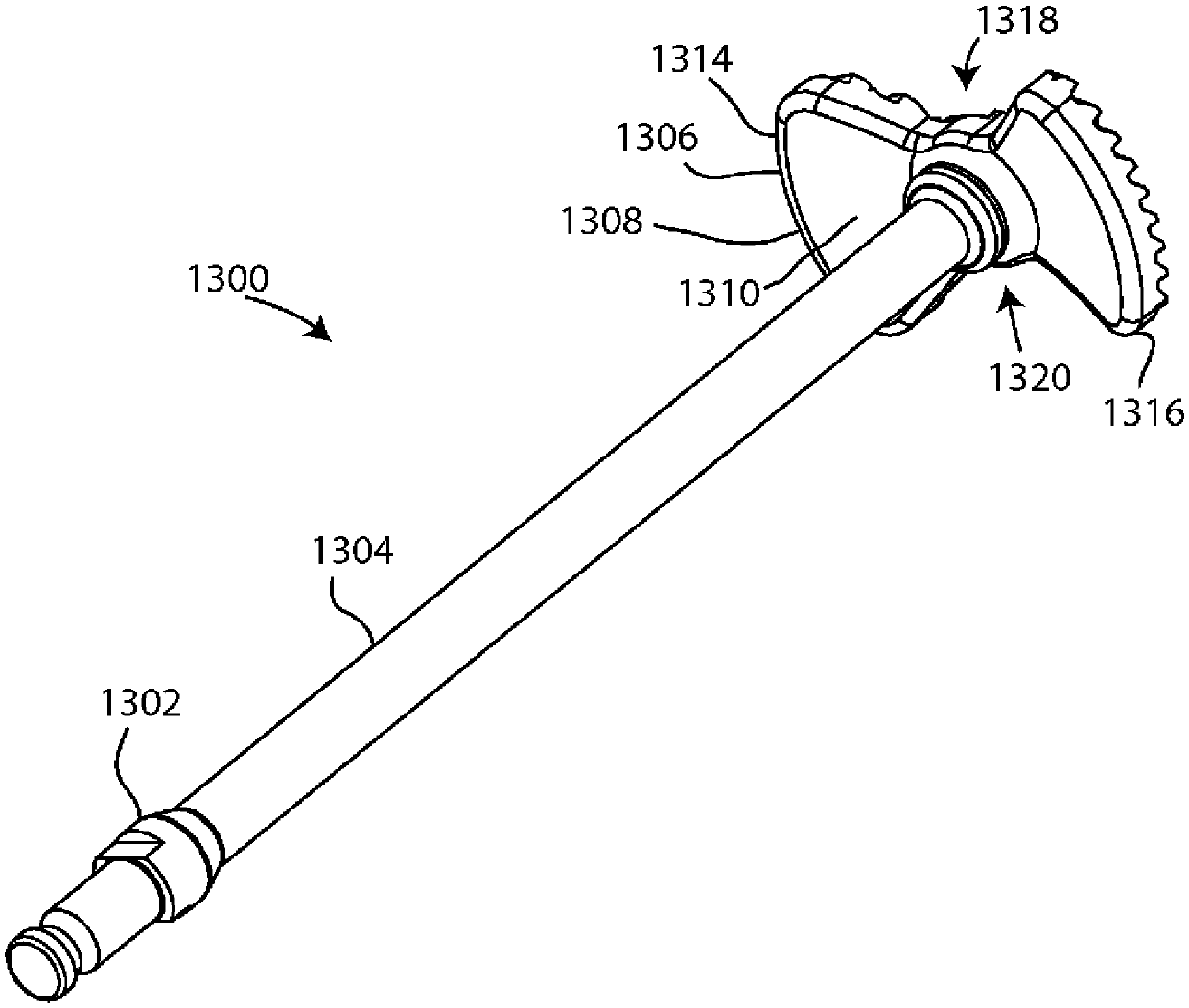 Glenoid arthroplasty