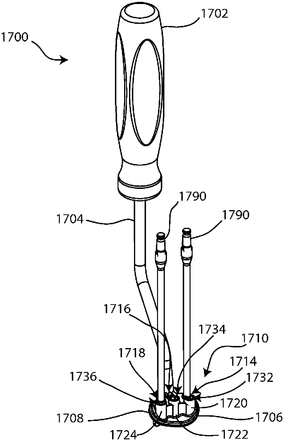 Glenoid arthroplasty