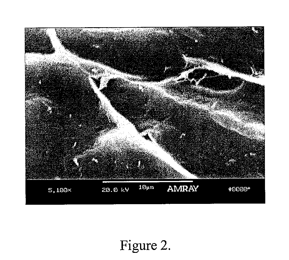 Bone matrix compositions having nanoscale textured surfaces