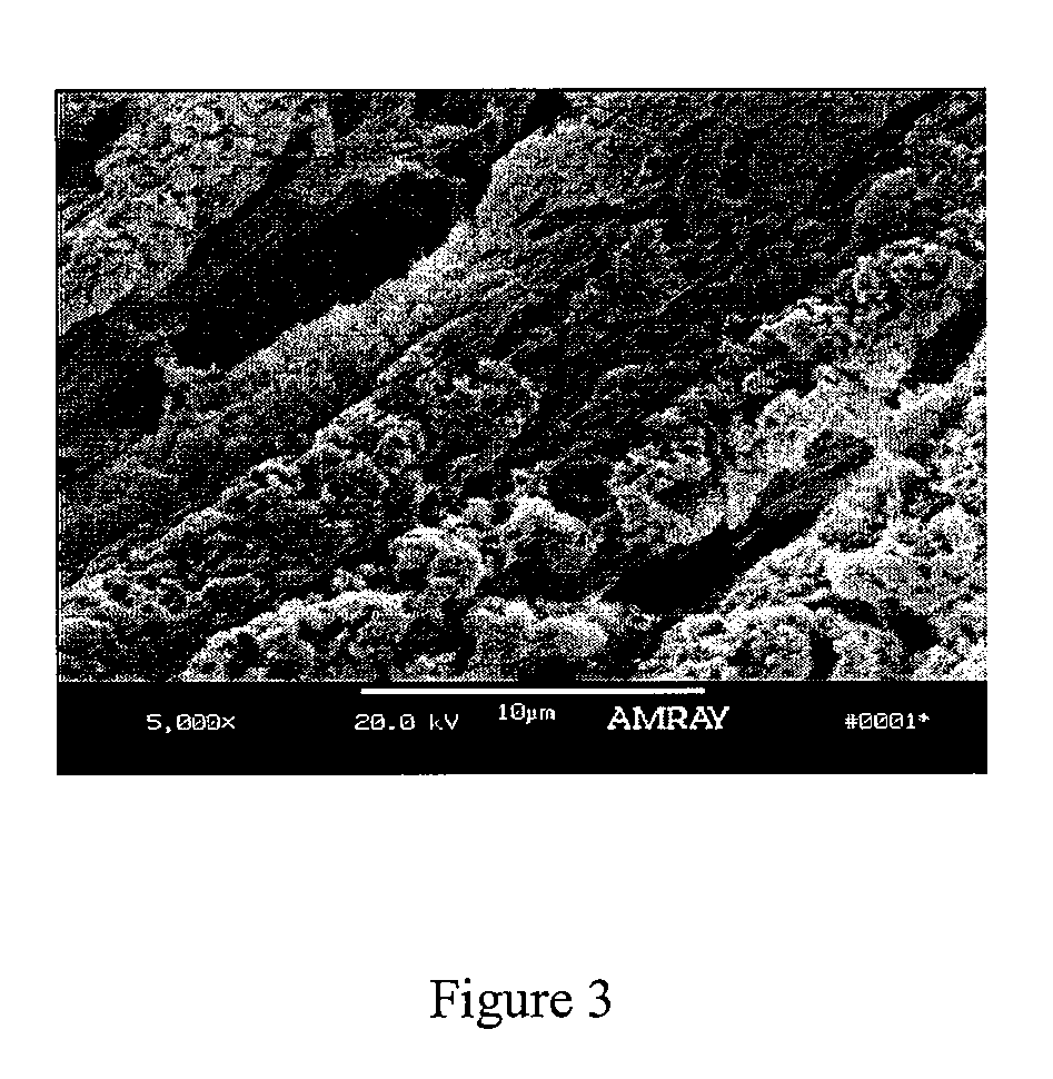 Bone matrix compositions having nanoscale textured surfaces