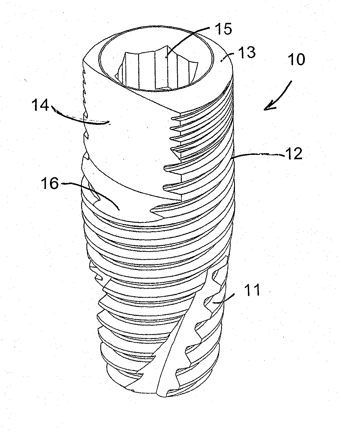 Dental implant