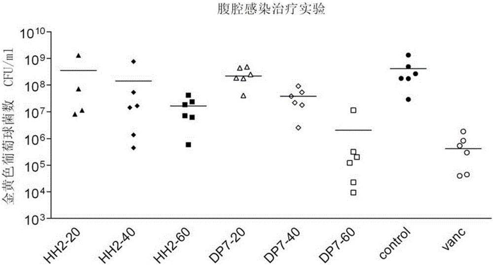 Polypeptide with antibacterial activity and application thereof