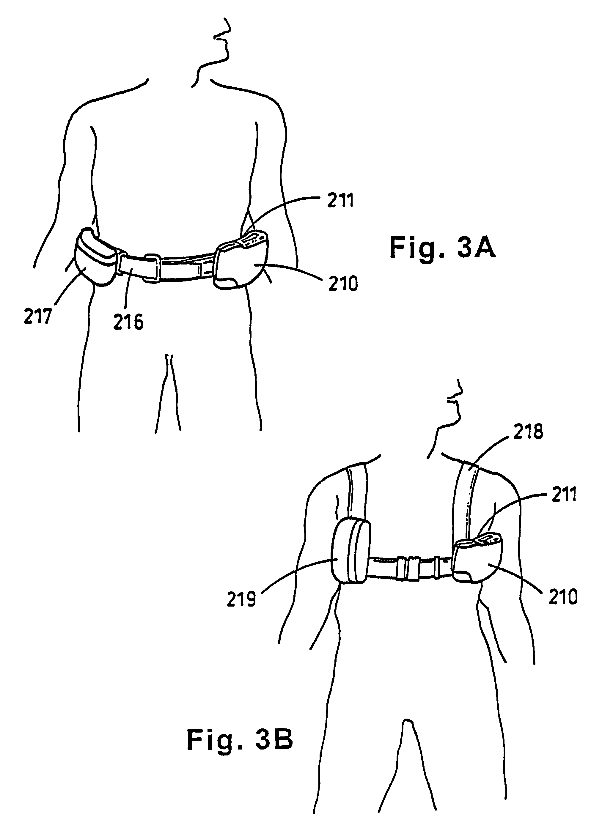 Portable wound treatment apparatus having pressure feedback capabilities