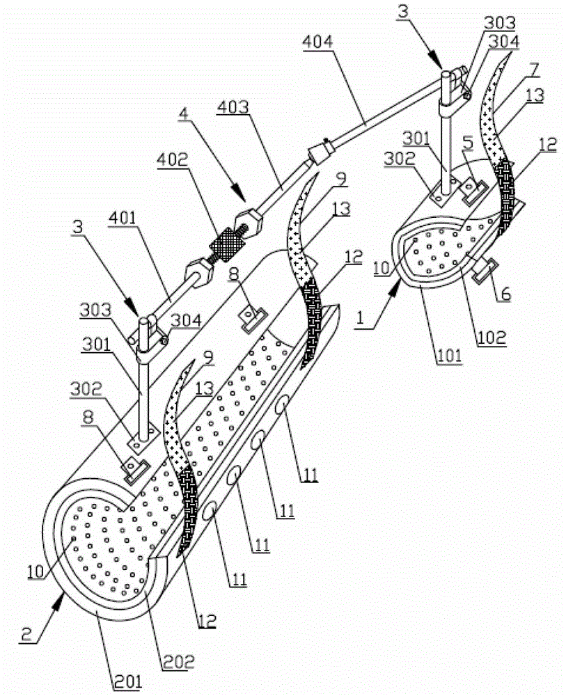 Noninvasive Adjustable Splint Bracket for Distal Radius Fracture