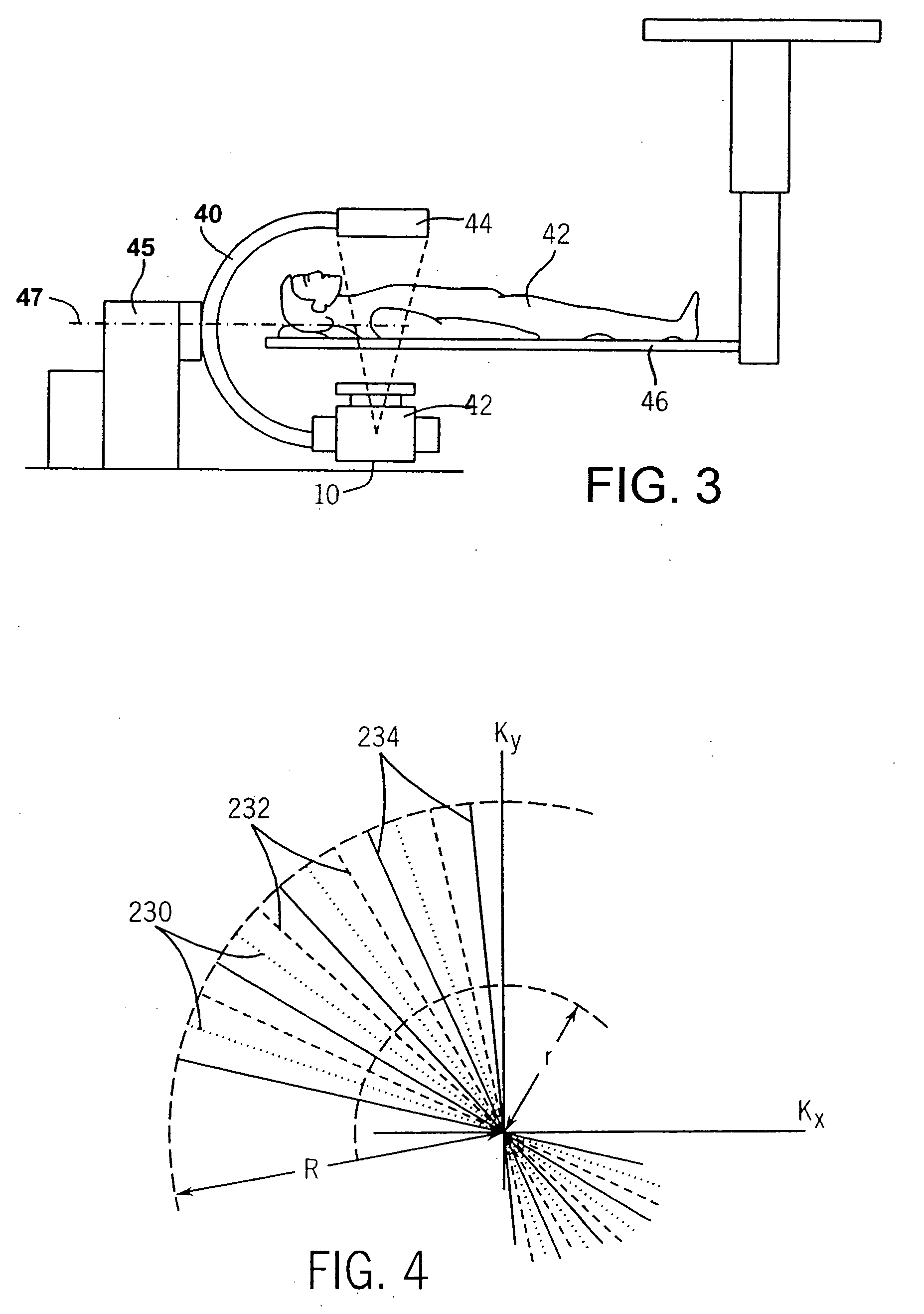 Backprojection reconstruction method for CT imaging