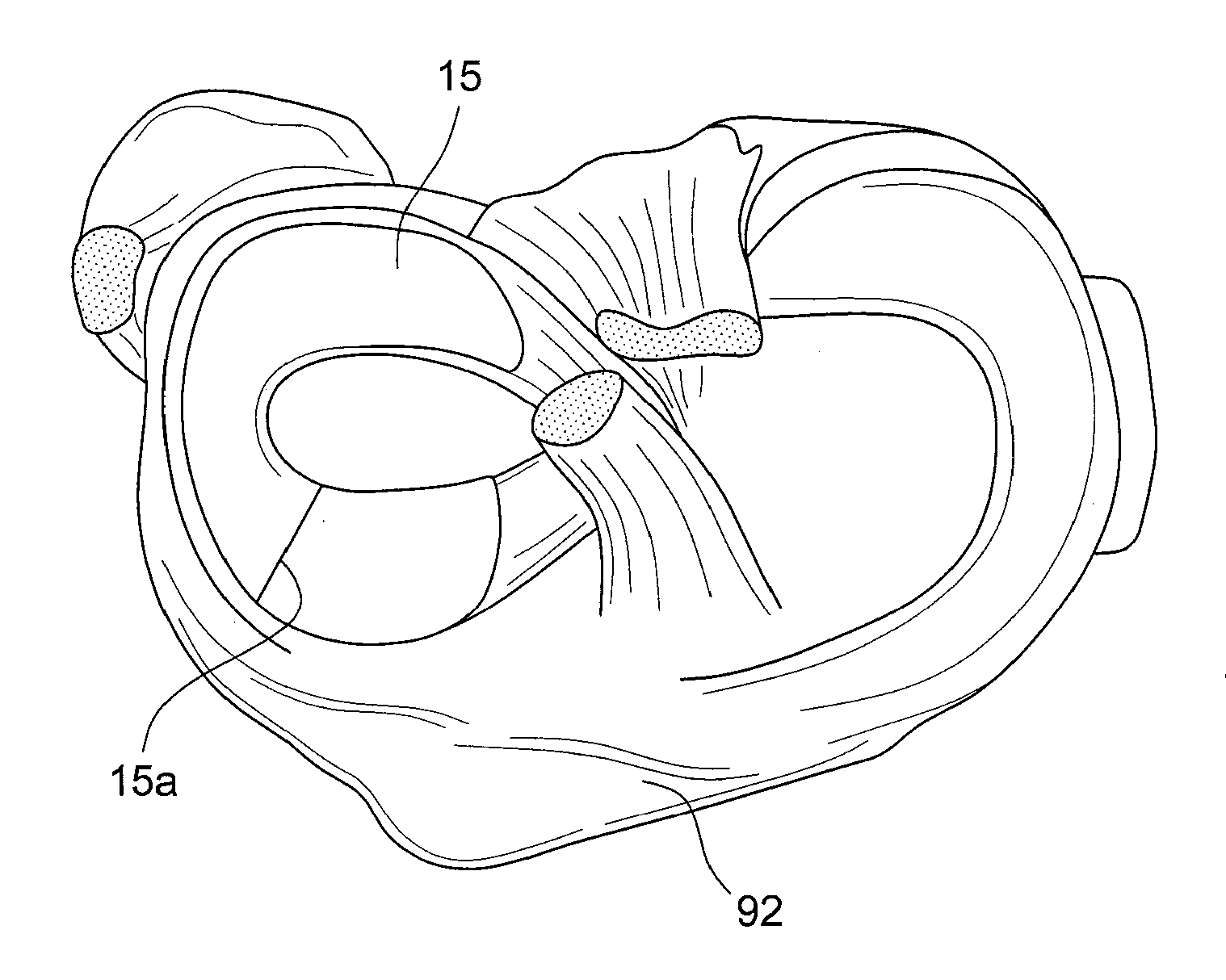 Biologic partial meniscus and method of preparation