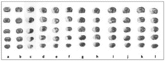 Excitotoxicity related injury treatment peptide