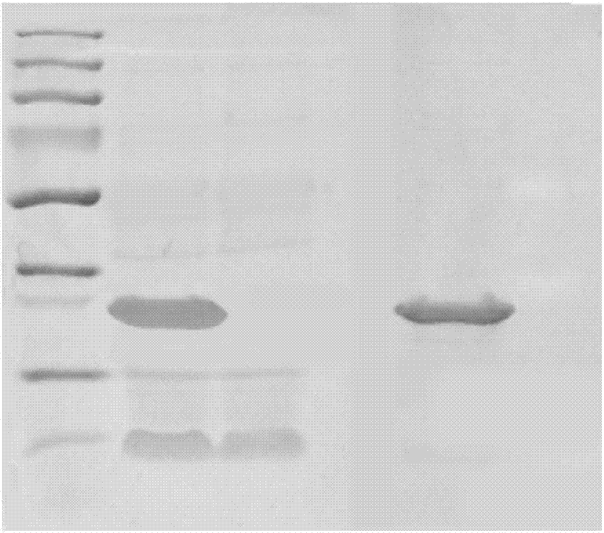 Excitotoxicity related injury treatment peptide