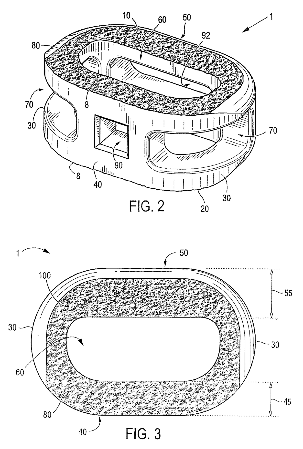 Process for fabricating bioactive vertebral endplate bone-contacting surfaces on a spinal implant