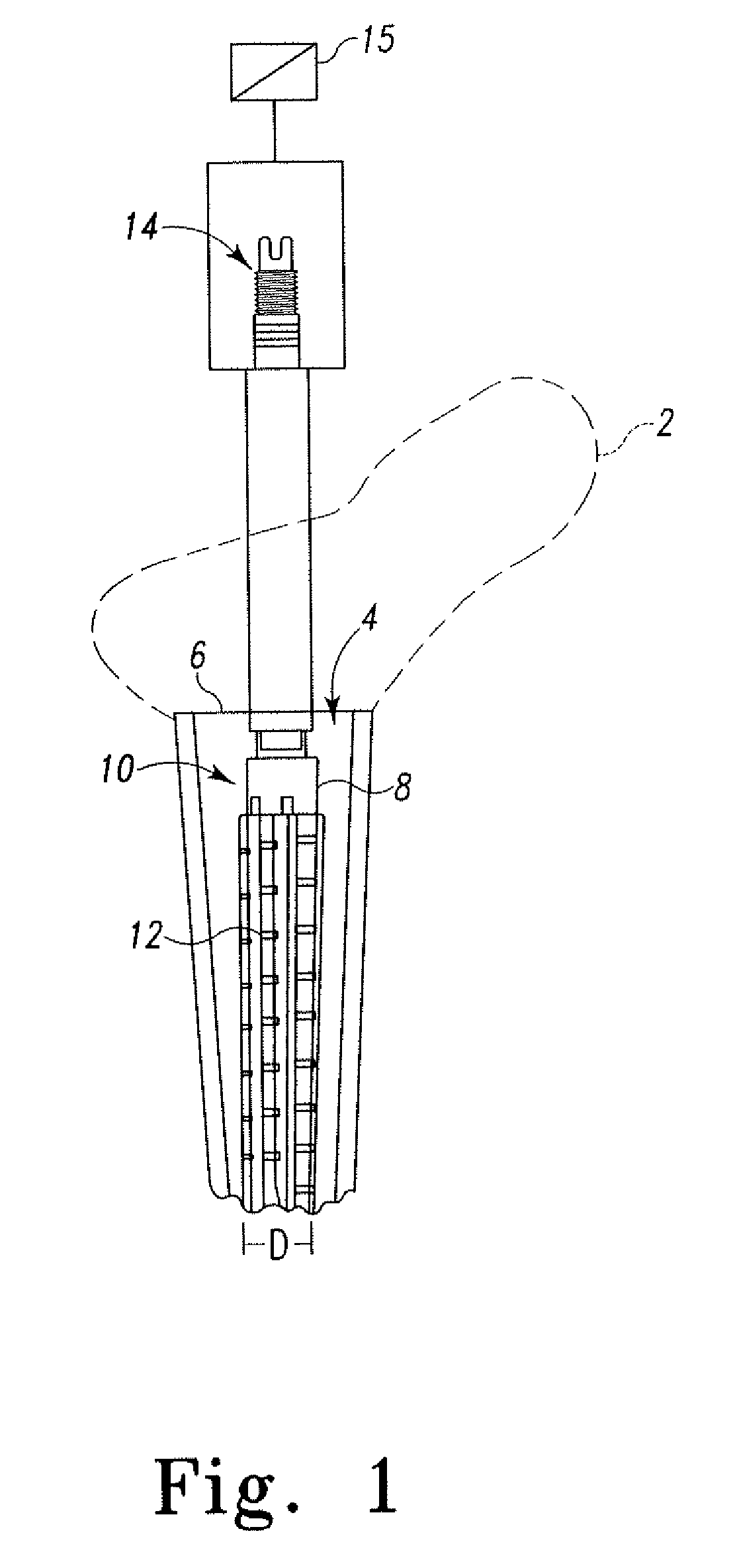 Expandable proximal reamer