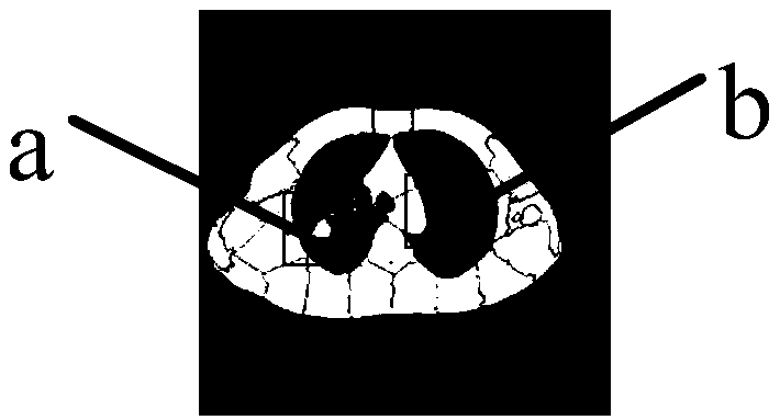 A superpixel method for medical image segmentation