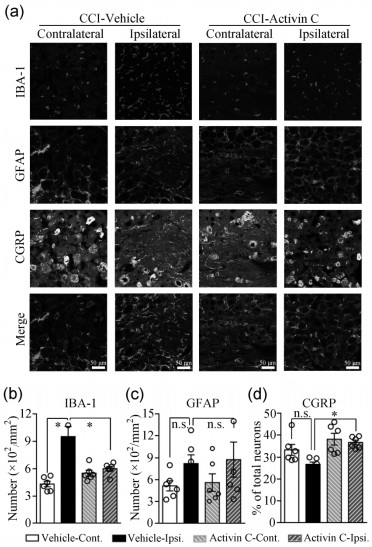 Application of cytokine activin C in treatment of neuropathic pain