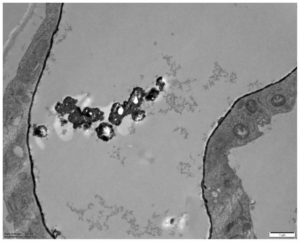 Method for relieving plant growth resistance under stress of high-concentration rare earth elements and application