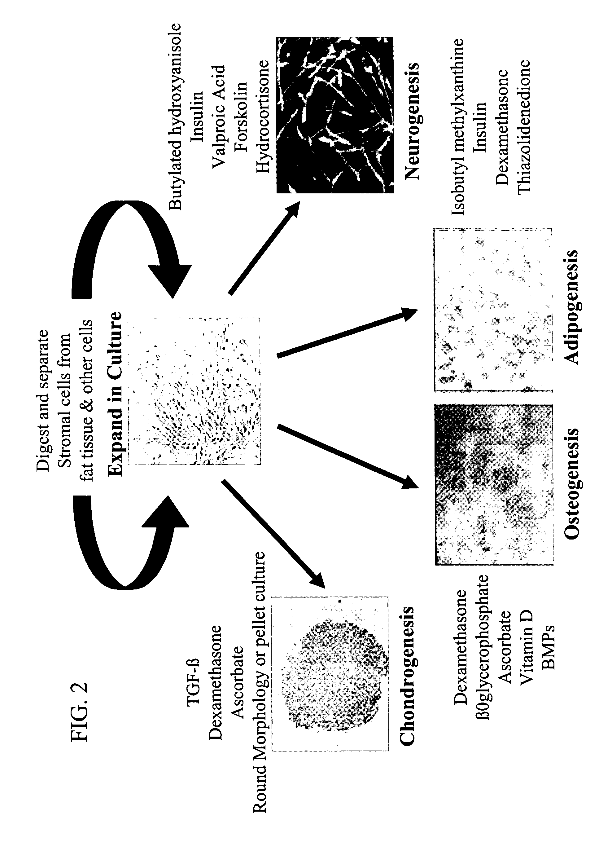 Use of adipose tissue-derived stromal cells in spinal fusion