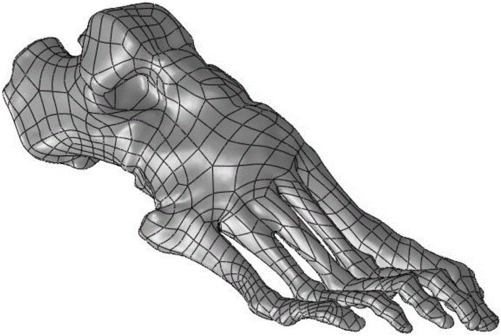 Individualized design method for diabetic foot shoe pad