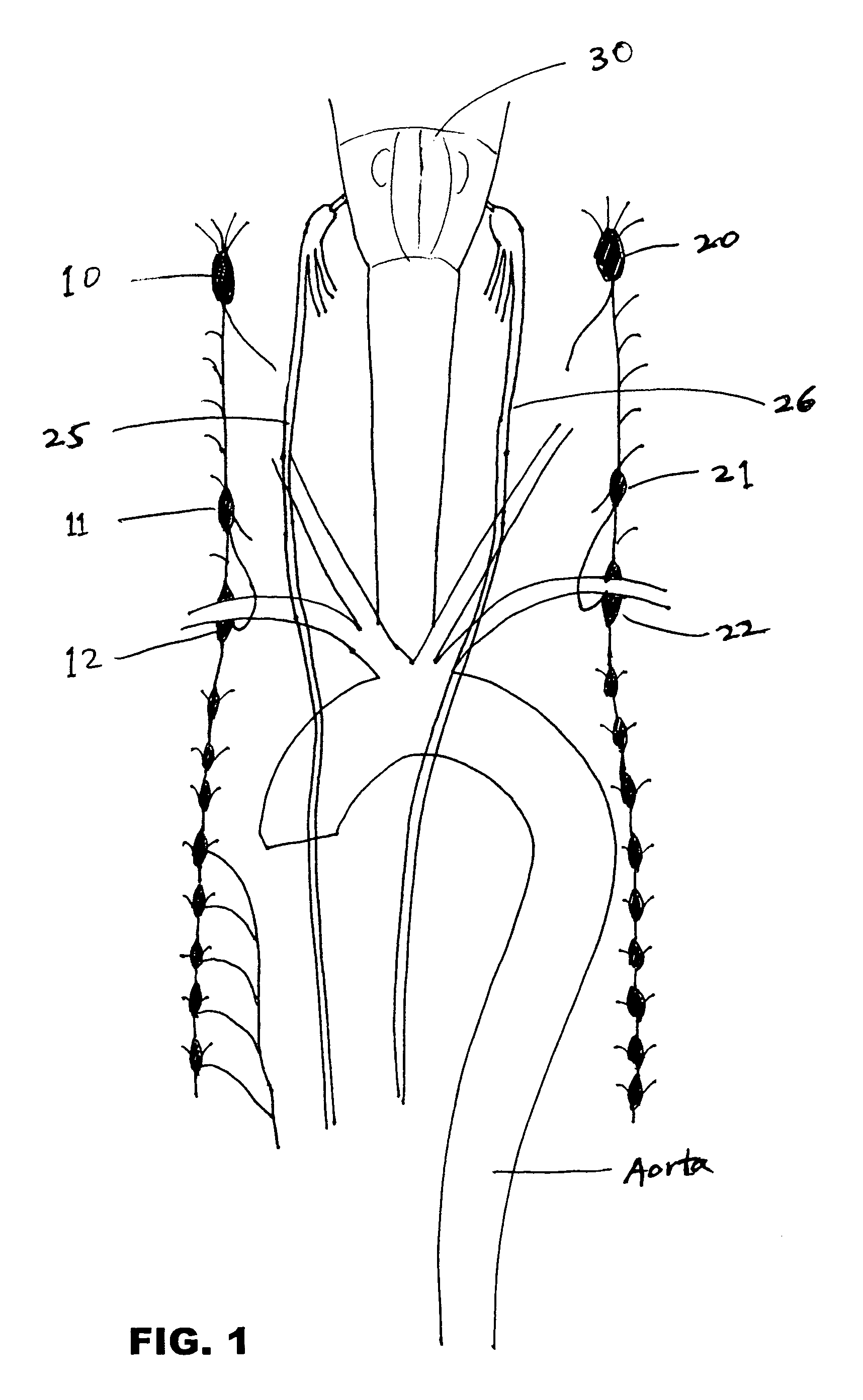 Enhancement of cerebral blood flow by electrical nerve stimulation