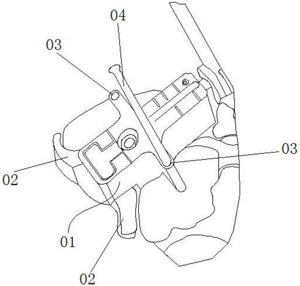 Corrector for joint replacement and use method thereof