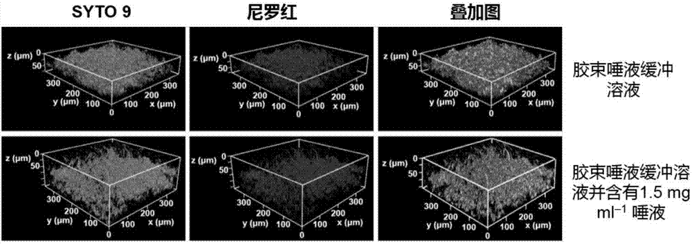 Preparation method for triclosan-containing poly(beta-urethane-urea) and application of triclosan-containing poly(beta-urethane-urea) in selectively killing oral streptococcus mutans of biofilm