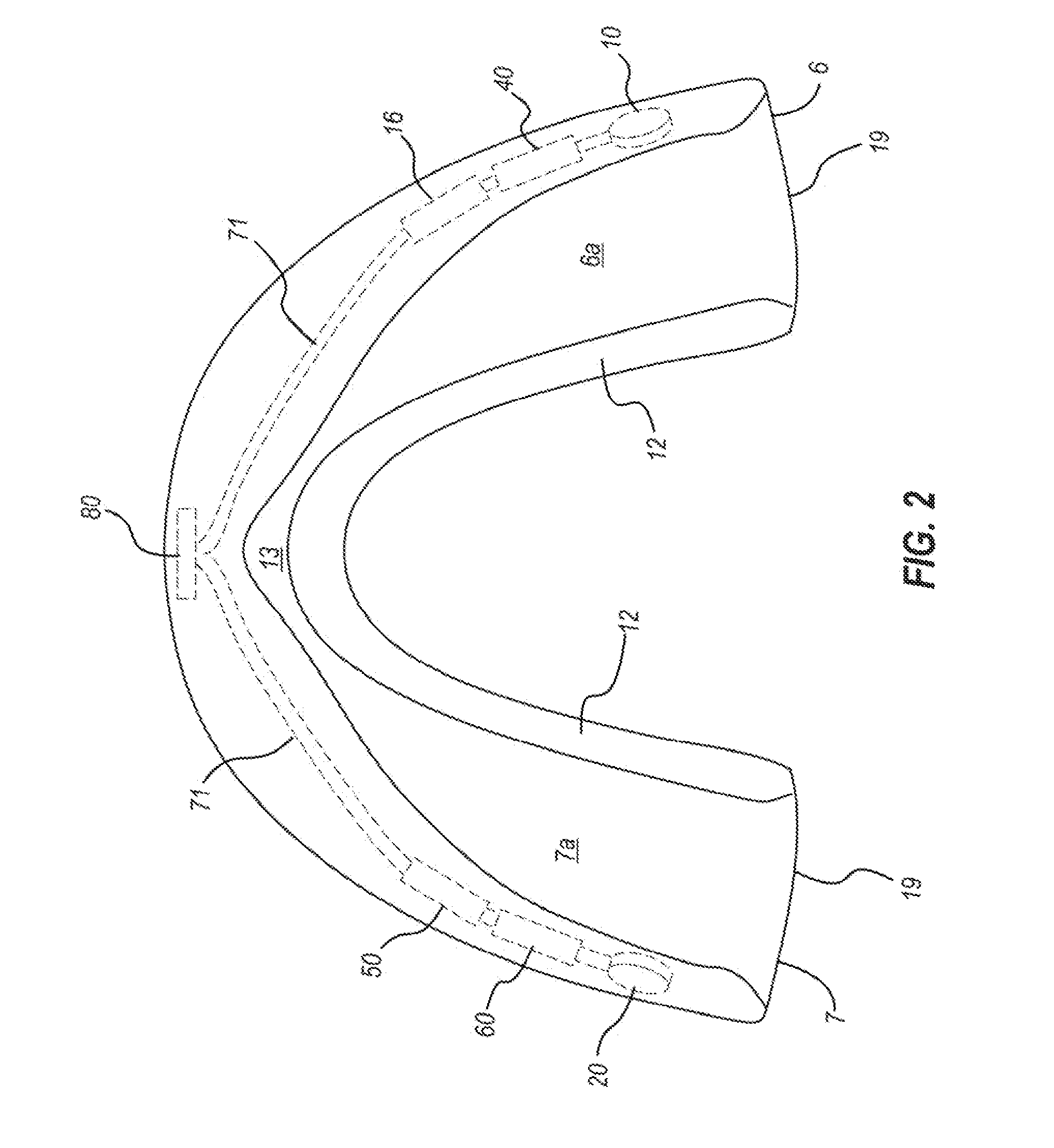 Impact Sensing Mouth Guard and Method