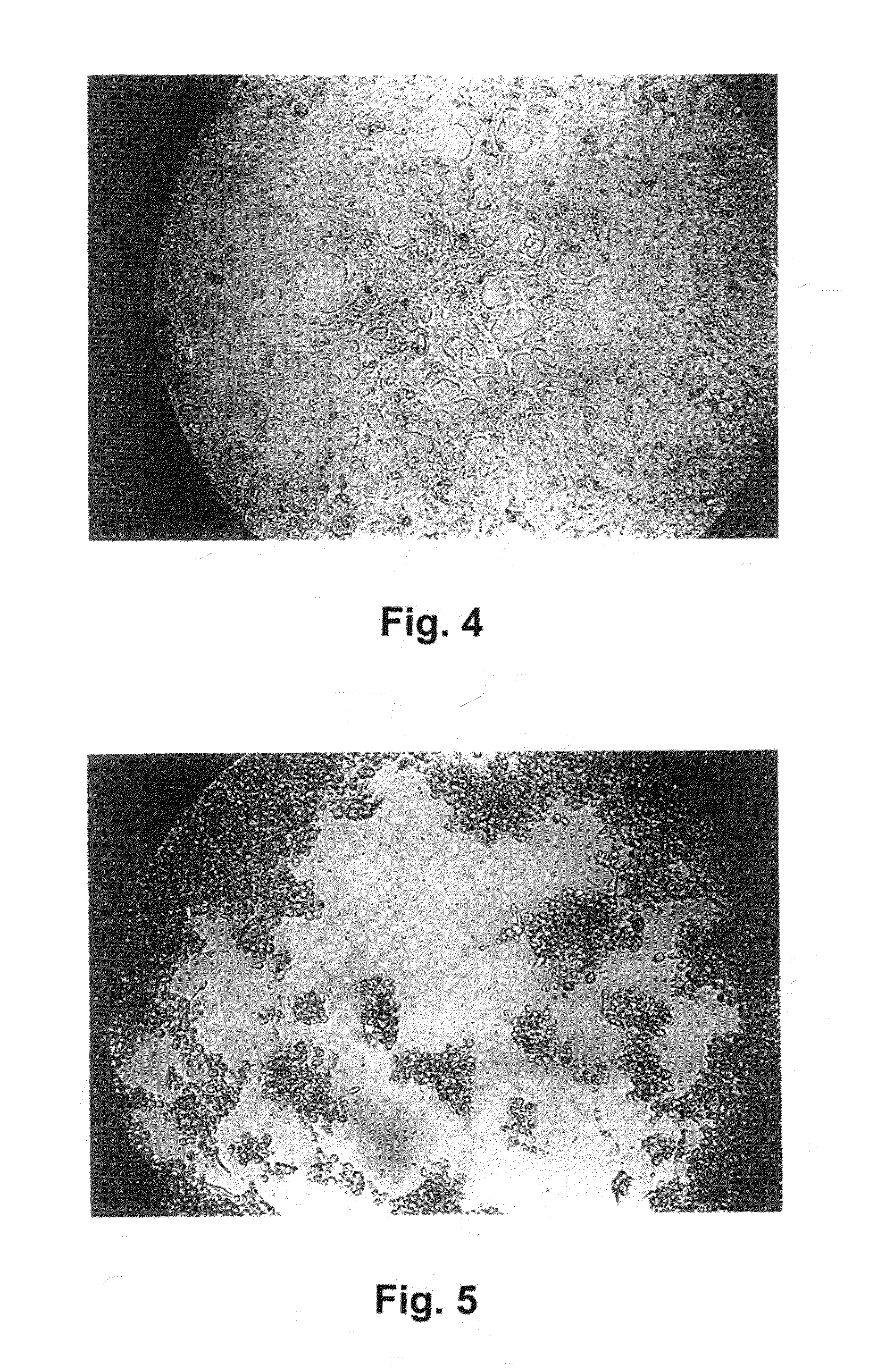 Alpha 1-acid glycoprotein, alpha 2-HS glycoprotein, alpha 1-antitrypsin, and fragments thereof induce apoptosis in cancer cell lines