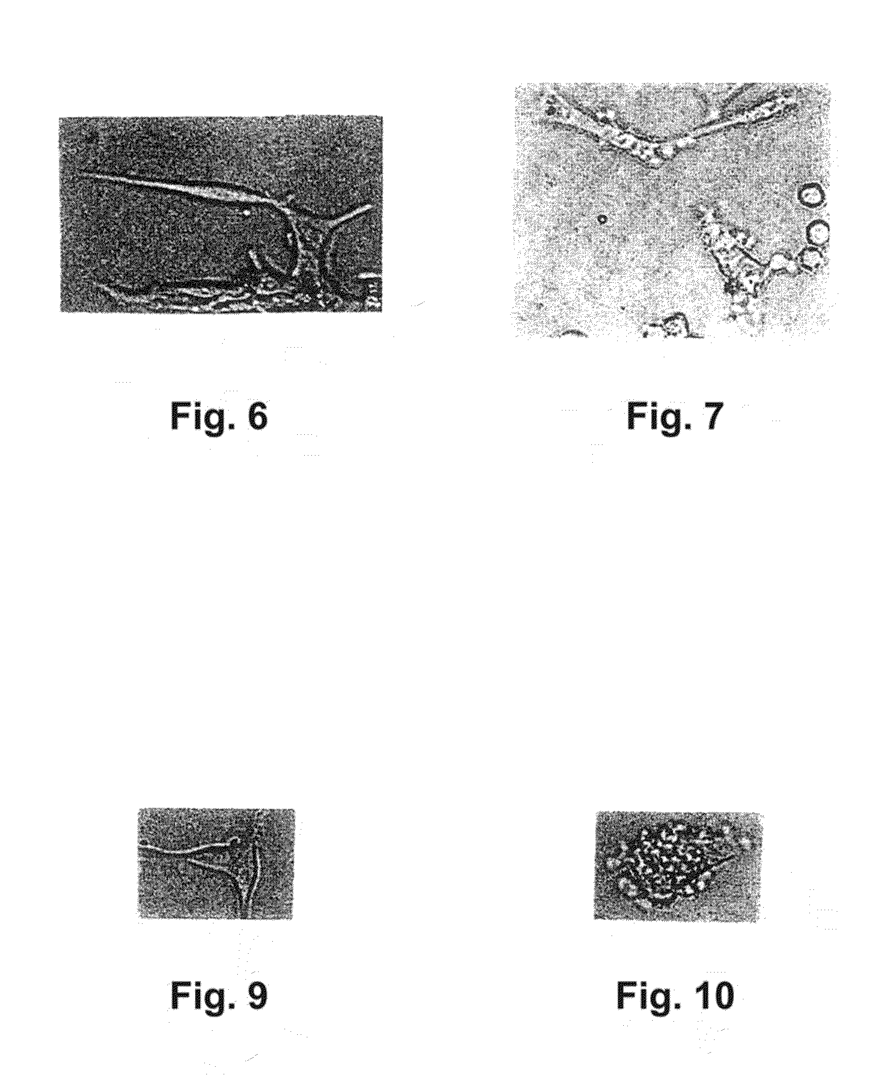 Alpha 1-acid glycoprotein, alpha 2-HS glycoprotein, alpha 1-antitrypsin, and fragments thereof induce apoptosis in cancer cell lines