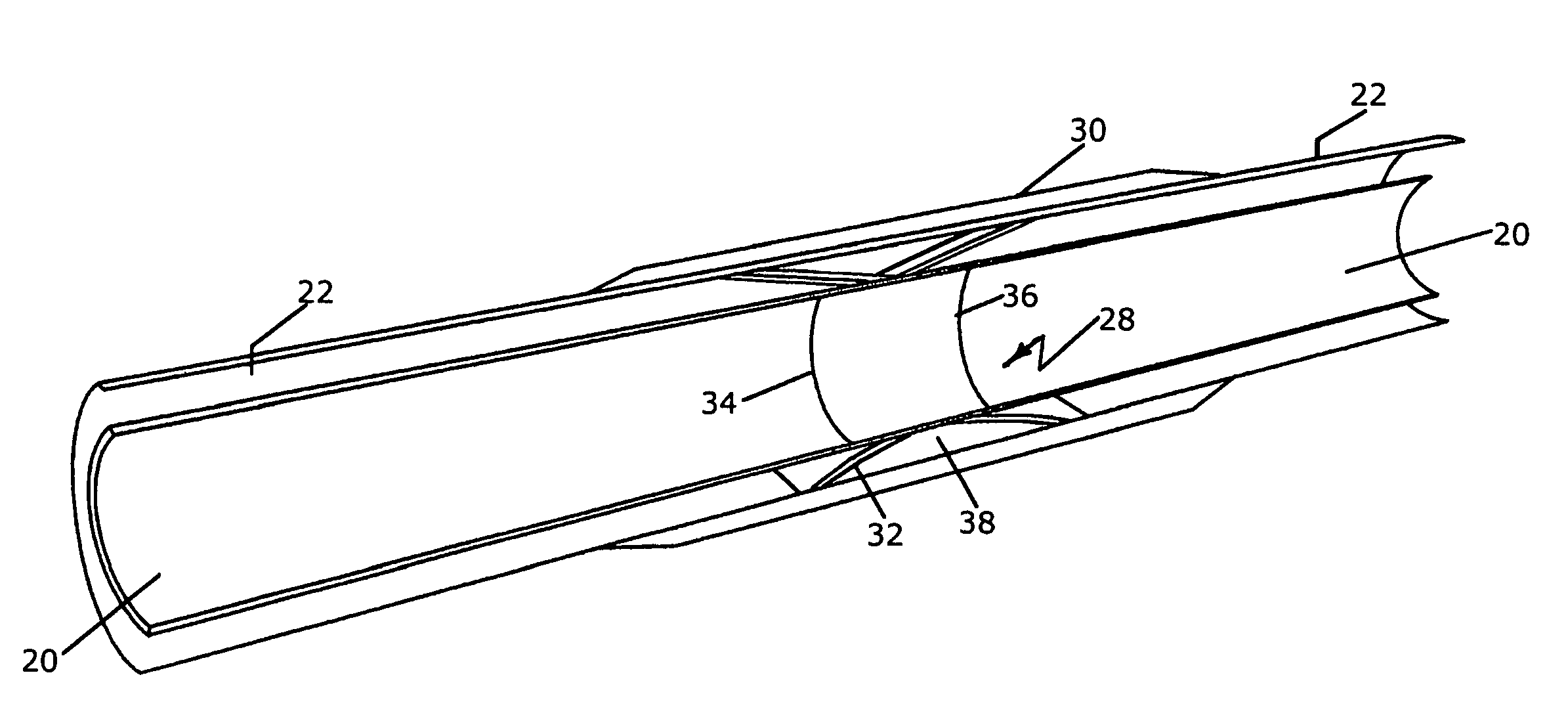 Advance instrumentation methods for pipes and conduits transporting cryogenic materials