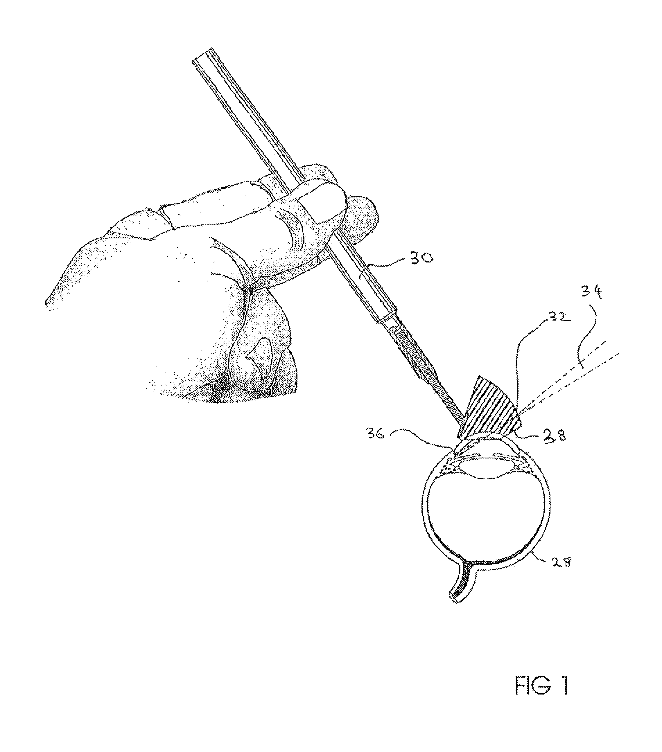 Suspended goniolens system