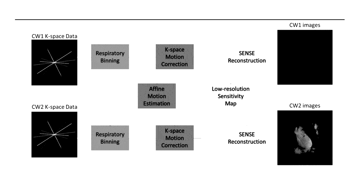 Motion corrected simultaneously acquired multiple contrast coronary MRI systems and methods