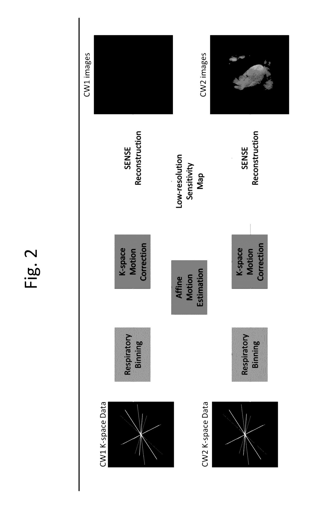 Motion corrected simultaneously acquired multiple contrast coronary MRI systems and methods