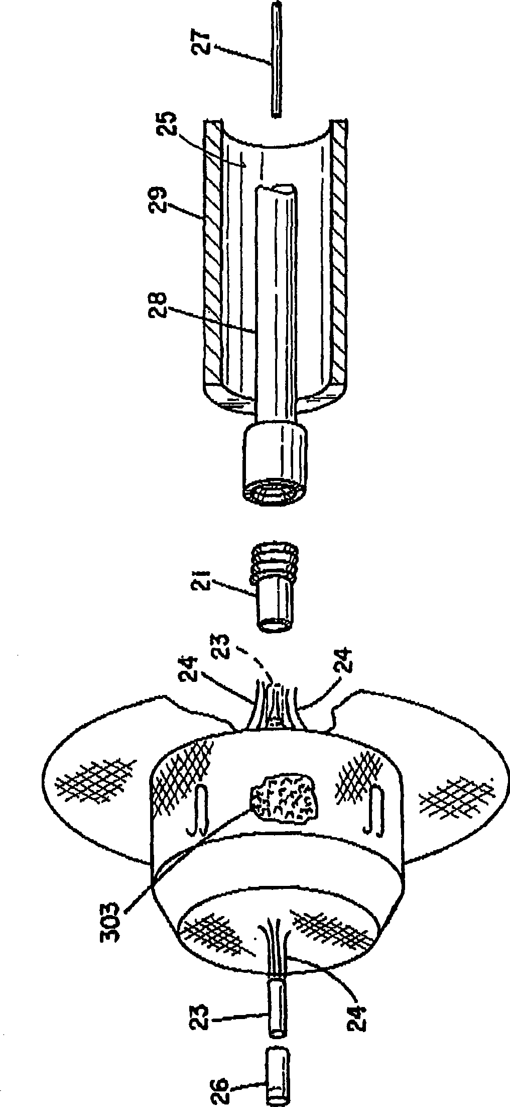 Percutaneous catheter directed intravascular occlusion device